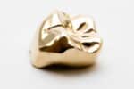 selling gold crowns what you should know 632b2f5c3015f