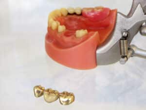 why choose a specialized dental scrap buyer 632b1fdd9c95c